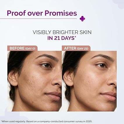 No Brand The Derma Co 10% Advanced Vitamin C Face Serum with 5% Niacinamide 30ml | Dark Spot & Pigmentation Serum daily… — thumbnail 6 of 9