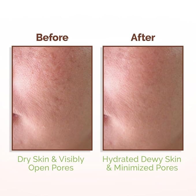 Mamaearth Mamaearth Rice Water Dewy Face Toner 150ml | Hydrating & Brightening Toner with Rice Water, Niacinamide & Aloe… — thumbnail 3 of 5